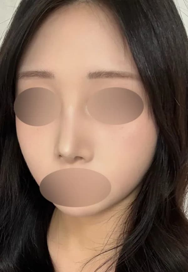 post-3326